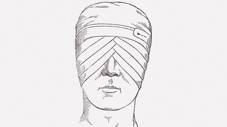 【閲覧注意】事故ったバイカーさん「両目、無くなったわー･･･」（動画）