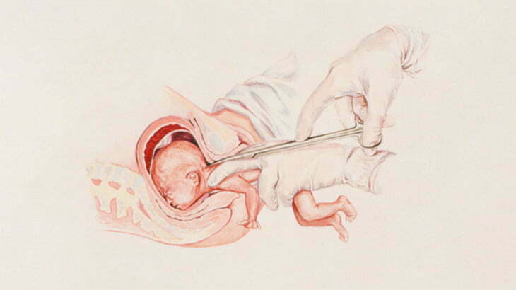 【閲覧注意】これを繰り返すお医者さん、そのうち発狂しそう･･･（動画）