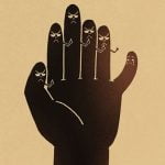 【微閲覧注意】合わせ鏡のような8本指の手「ミラーハンド症候群」（画像）