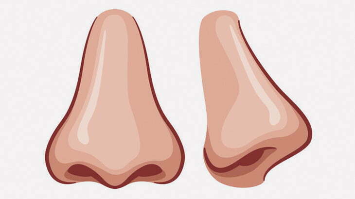 鼻の形がおかしいので整形した人達ビフォーアフター（画像）