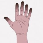 女「手の指、凍傷しちゃったｗｗｗ」（画像）