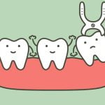 【閲覧注意】歯を抜いて別の場所に植え付ける手術（動画）