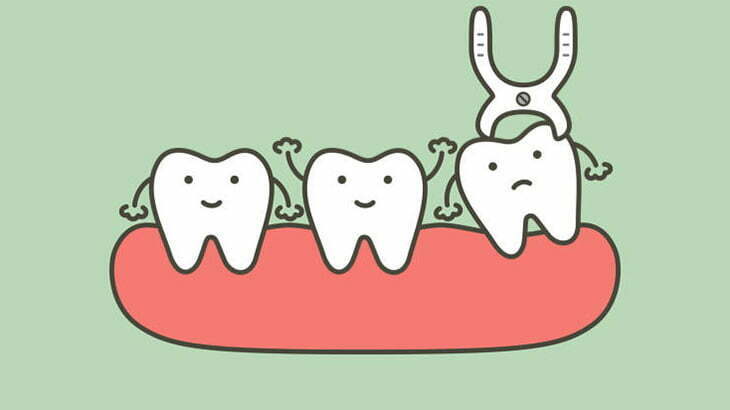 【閲覧注意】歯を抜いて別の場所に植え付ける手術（動画）