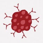 【閲覧注意】男「お腹に出来た肉腫を切除してもらいました」（画像）