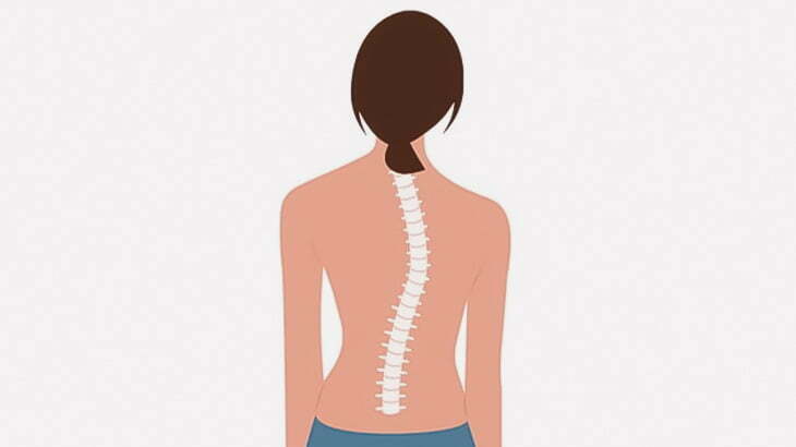 【閲覧注意】背骨が捻れてしまった女性の手術過程（画像）