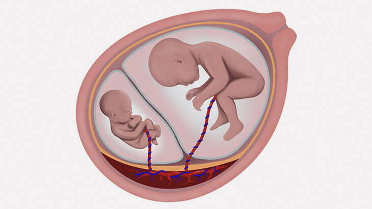 【閲覧注意】1歳の幼児の脳からこんなものが摘出される･･･（画像）