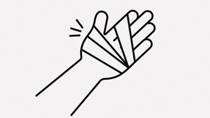 【閲覧注意】工場作業員、油圧プレスに手のひらを破壊されてしまう･･･（画像）