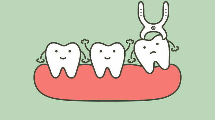 【閲覧注意】抜歯した女性、とんでもないことに･･･（画像）