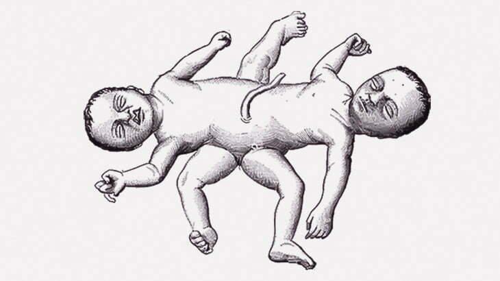 ガソリンスタンドに三輪バイクで結合双生児が給油に来た（動画）