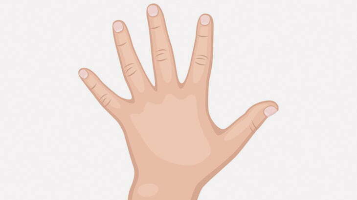 【閲覧注意】事故ったバイカーの指先、切断されてしまう（動画）