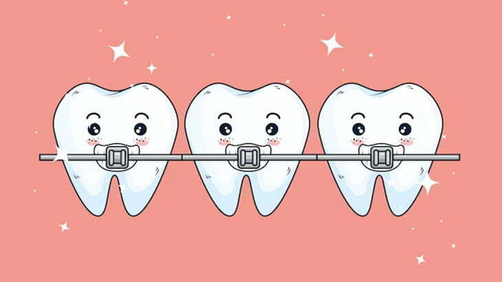 ガッチャガチャな歯の歯列矯正タイムラプス（動画）