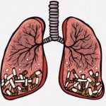 【閲覧注意】医師「これが30年間喫煙し続けた人間の肺です」（動画）