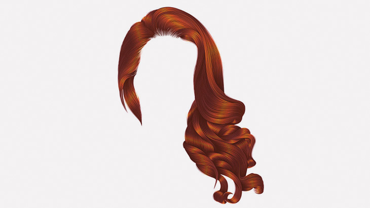 【閲覧注意】頭皮が剥がれたこの女性、犬にやられたそうです･･･（画像）