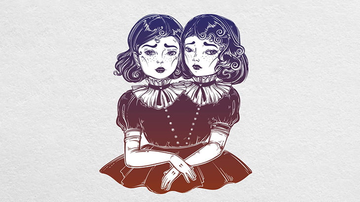 【閲覧注意】結合双生児として生まれた姉妹「カルメンとルピタ」（画像）