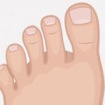足の指が9本ある男性、手術で正常な指に（画像）