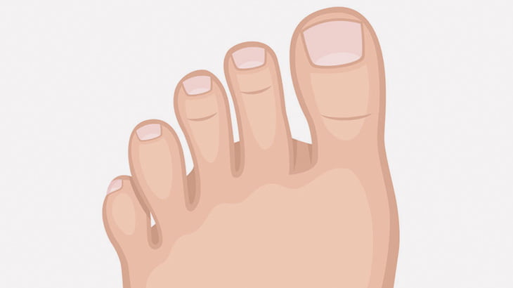 足の指が9本ある男性、手術で正常な指に（画像）
