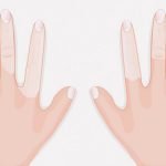 指が真っ白になってしまう病気「レイノー症候群」（動画）