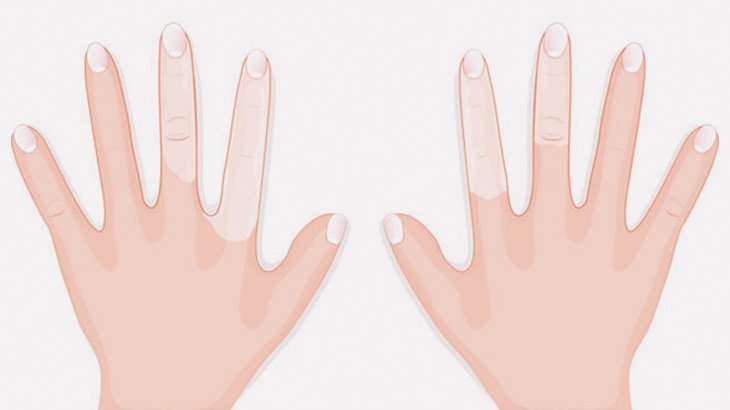 指が真っ白になってしまう病気「レイノー症候群」（動画）