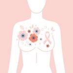 【閲覧注意】乳がんの女性、皮膚移植で切除した胸の膨らみを補う（画像）