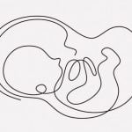 【閲覧注意】妊娠14週で流産してしまった胎児、こんな姿だった･･･（画像）