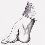 【閲覧注意】纏足（てんそく）が行われていた時代から生きるお婆ちゃんの足（動画）