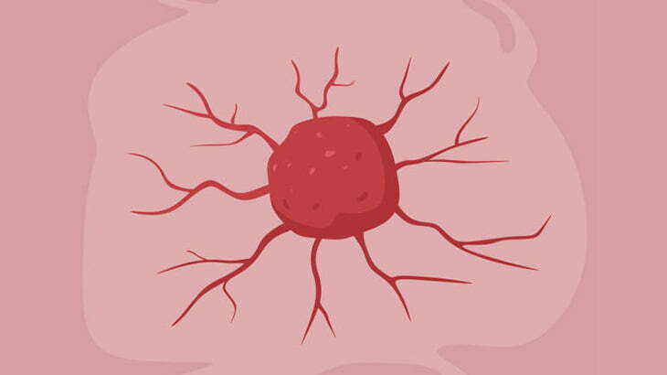 顔に大きなコブが出来てしまった男のビフォーアフター（動画）