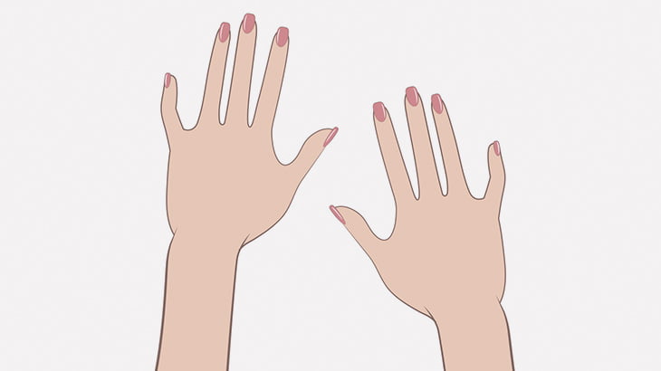 この女性の両手、コブだらけ･･･（動画）