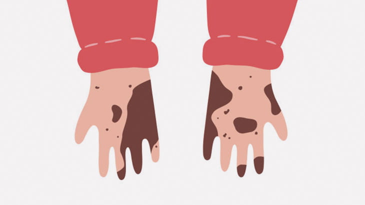 【閲覧注意】土いじりした後の爪にはこんな奴らがいっぱいいますよ･･･？（動画）