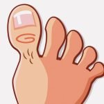 【閲覧注意】男「足の親指とれちゃったｗｗｗ」（動画）