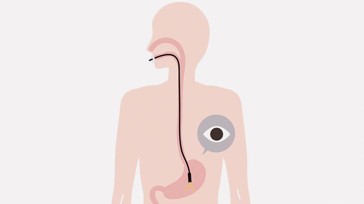 女性医師さん、自分の口に胃カメラを突っ込んでセルフ検査（動画）
