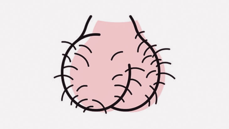 【閲覧注意】男「キンタマ袋を切り開いて睾丸を引っ張り出してやったわｗｗｗ」