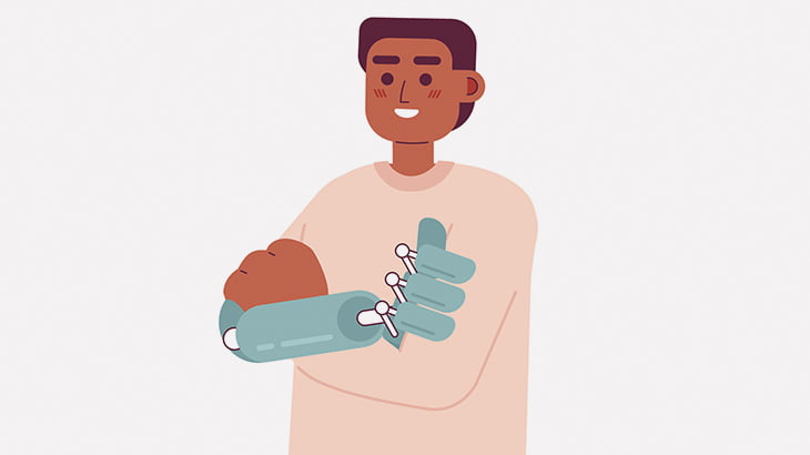 義体化の未来はもうすぐそこ？両腕を失った男性が義肢を操作することに成功（動画）