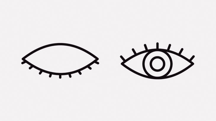 口の動きに連動してまぶたが上がり下がりする「マーカスガン症候群」（動画）