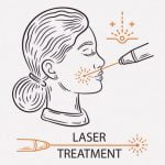 顔の皮膚に小さな点の穴を開けて皮膚の再生を促すフラクショナルレーザー治療（動画）