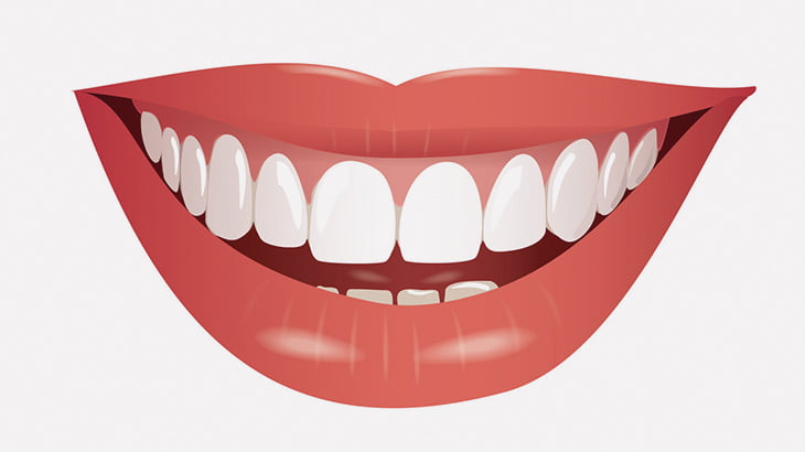 唇の周りの角栓をひたすら絞り出す施術（動画）