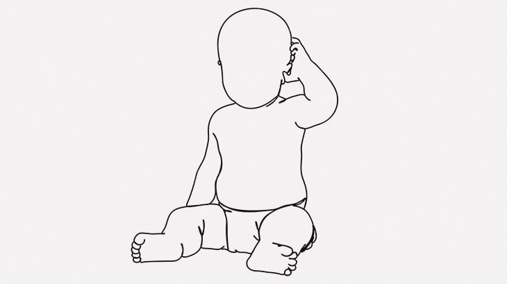 生まれてきた我が子は両目が塞がれてました･･･