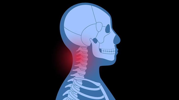 男「バスケのゴールネットにぶら下がるから撮影してて！」 → 首を骨折（動画）