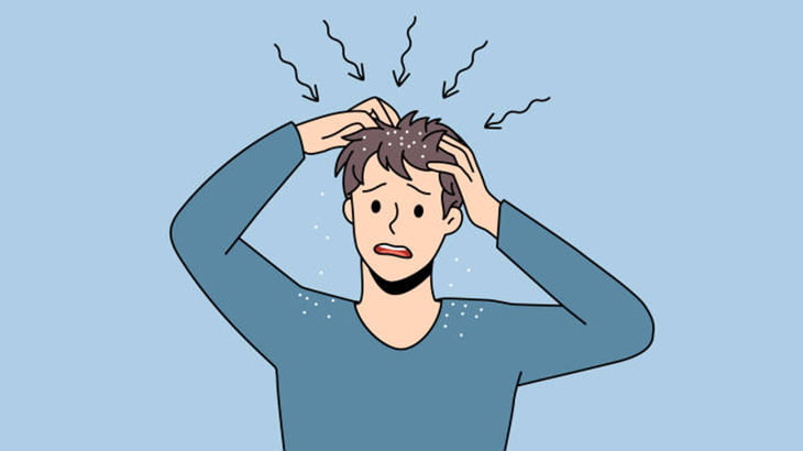 この男性の頭皮、フケで覆われてる･･･（動画）