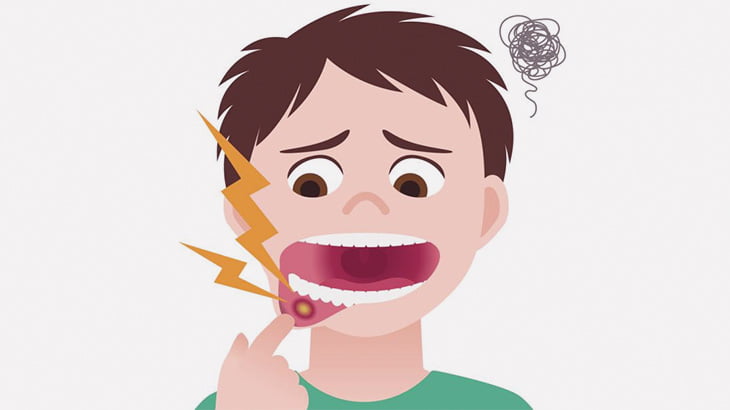 少年「口内炎ムカつく！塩を塗ってやんよ！」（動画）