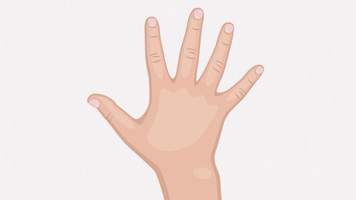 【閲覧注意】工場作業員の手が機械に挟まる → 手袋みたいに剥がれてしまう･･･（画像）