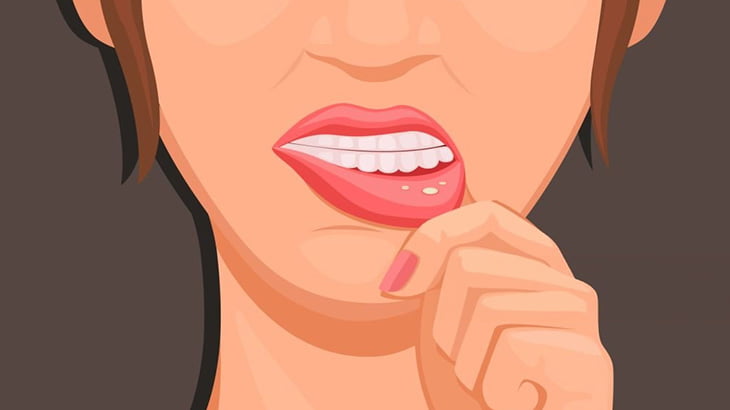 涙を流す女「ひどい口内炎になっちゃった･･･」（動画）