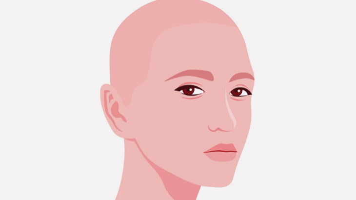 女性「抗がん剤治療で髪の毛が全部無くなっちゃったけど元気です」（動画）