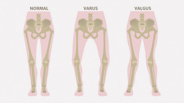女「私の脚、ちゃんと閉じること出来ないんだよね」（動画）