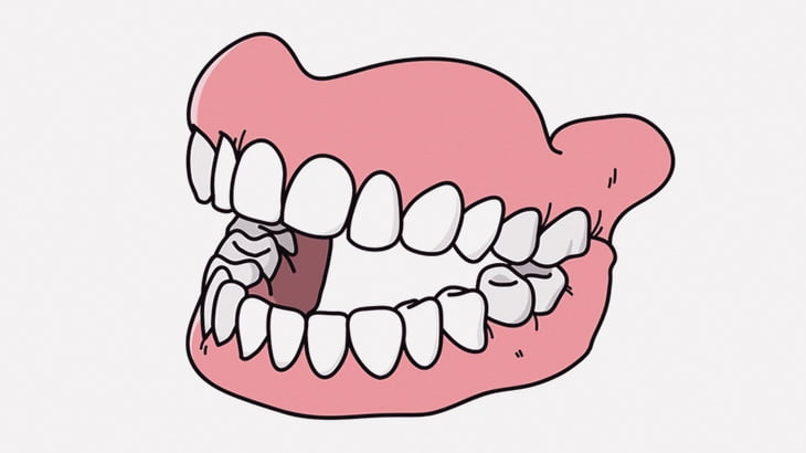メイクすると１０歳くらい若返る歯が無いオバさん（動画）