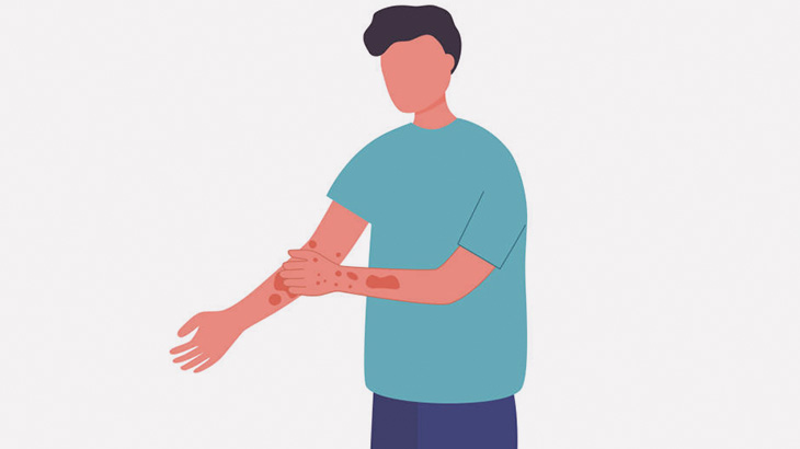 男「腕の皮膚をむしらなきゃ･･･！むしらなきゃ･･･！」（動画）