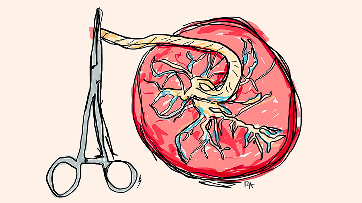プラセンタ（動物の胎盤）カプセルはこうして作られます