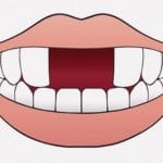 前歯が２本くらい抜けている、笑顔が不気味な半グレっぽい男