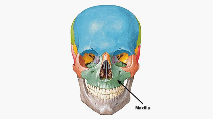 男「上顎がんでこんな状態になっちまったよ･･･」