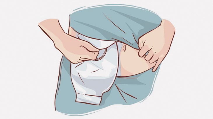 人工肛門の男性がパウチを装着する日々のルーティン作業